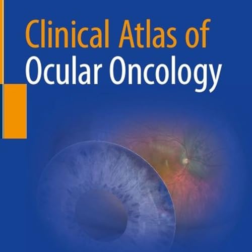 Clinical Atlas of Ocular Oncology