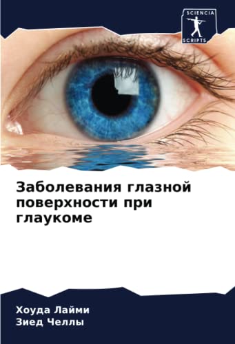 Заболевания глазной поверхности при глаукоме (Russian Edition)