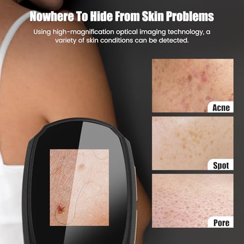 Image of Handheld Dermatoscope Skin Analyzer Machine, Wireless Portable Digital Microscope with 1080P IPS Screen 8 LEDs, 500X Magnifier, for Scalp /Hair Trichomes
