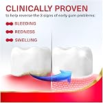Parodontax Active Gum Repair Toothpaste, Toothpaste To Help Reverse Signs Of Early Disease For Health, Fresh Mint Flavored - 3.4 Oz x 3 - Image 2