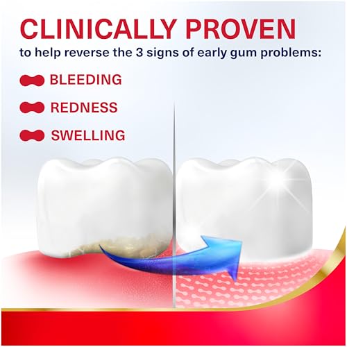 Active Gum Repair Toothpaste, Toothpaste To Help Reverse Signs Of Early Disease For Health, Fresh Mint Flavored - 3.4 Oz x 3