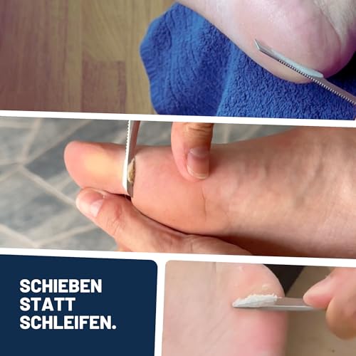 Mr. Fuss® No. 4 - Plus Pack Steel - Groß, Nagelhaut- Hornhautentferner Sparpaket 3 tlg. Aktiv-Lösung Schnell erweichend - 500 ml, Watte, Edelstahl-Schaber