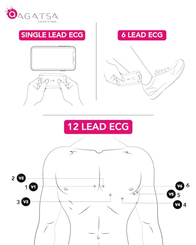Sanketlife 2.0 Portable ECG Machine | Car Keychain Size Touch-Based 12 Lead ECG Device | for 1/6/12 Lead ECG, Hrv by Touch | Get A Live Demo | Report-Analysis by Experts | ISO & CDSCO Cleared
