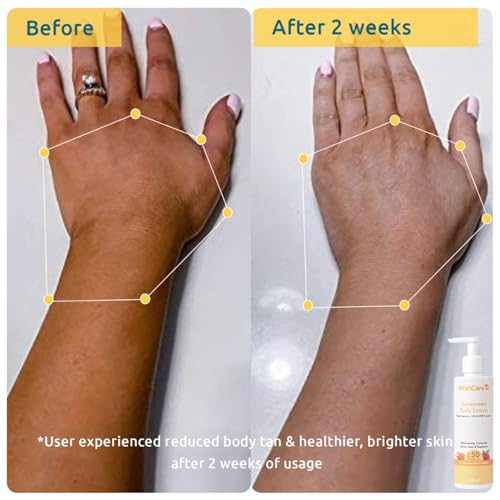 Image of WishCare SPF 50 Head-to-Toe Sun Protection Range | Sunscreen Body Lotion + Niacinamide Face Sunscreen + SPF Lip Balm | Lightweight, Non Greasy & No White Cast | 200ml + 50g + 5g