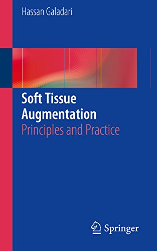 Soft Tissue Augmentation: Principles and Practice (English Edition)