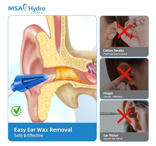 MSA Hydro Ear Wax Remover Kit, Safe, Quick and Effective Ear Cleaning, Gentle Ear Irrigation and Flushing, Adults and Children, Adjustable Water Pressure (Hydro Kit)