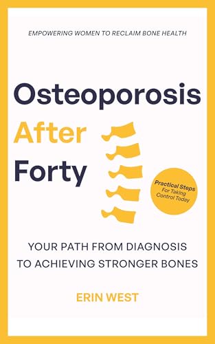 Osteoporosis After 40 Empowering Women Reclaim Bone Health: Your Path from Diagnosis to Achieving Stronger Bones. Practical Steps For Taking Control Today (Bone Vitality Series)