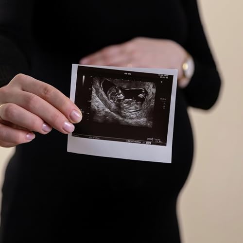 FINAL DAY PreBorn Ultrasound Campaign Sprint &ndash; We Did It! 385 Lives Touched