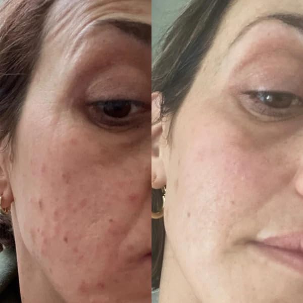 Gin Amber Beauty - Vitamin C (10%) + Squalane Repair Cream - Face Moisturizer - Skin Cream - Dark Spot Corrector - Primer (1 fl oz - 30ml) - Image 7