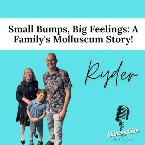 Small Bumps, Big Feelings: A Family's Molluscum Story!