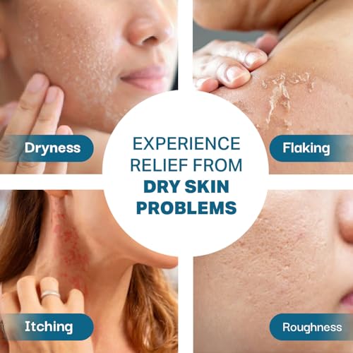 Image of Intensive Moisturizing Cream| For Sensitive Dry to Normal Skin| Pack Of 1X100ml