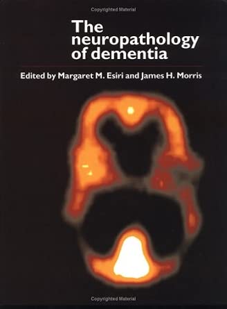 The Neuropathology of Dementia-Wow! eBook