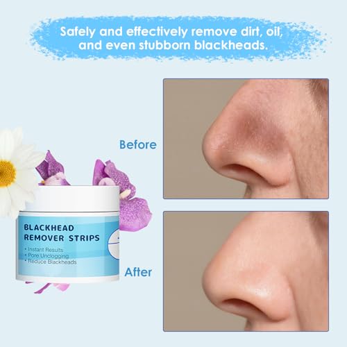 MRYXGJ 100Pcs-50g Blackhead Remover Strips, Nose & Facial pore cleaner Kit with pore minimizer Serum(30g), Deep Cleansing Pore Strips,black head remover for face & nose
