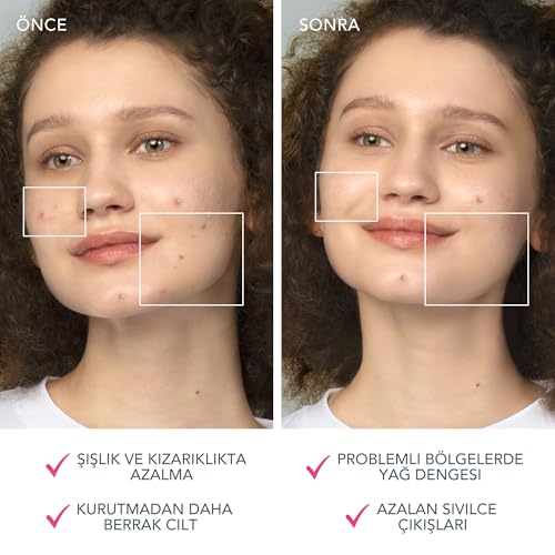 FOREO ESPADA 2 terapia światłem LED, urządzenie do pielęgnacji skóry, silikon klasy medycznej, leczenie blizn, usuwanie pryszczy, wyczyszczone przez FDA, fuksja