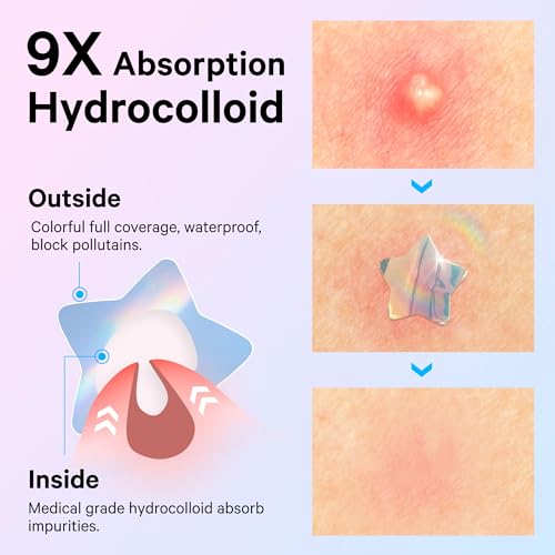 Image of Sosky Hologram Pimple Patches for Face, Hydrocolloid Acne Patches with Salicylic Acid, Cute Star Zit Stickers,Colorful Blemish Covers,36 Count Blue Pink Moon Cloud Flower