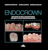 Endocrown: Una nuova via per la ricostruzione dei denti trattati endodonticamente (Italian Edition)
