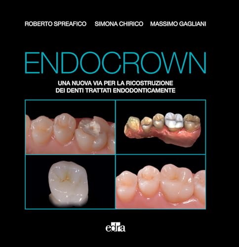 Endocrown: Una nuova via per la ricostruzione dei denti trattati endodonticamente (Italian Edition)