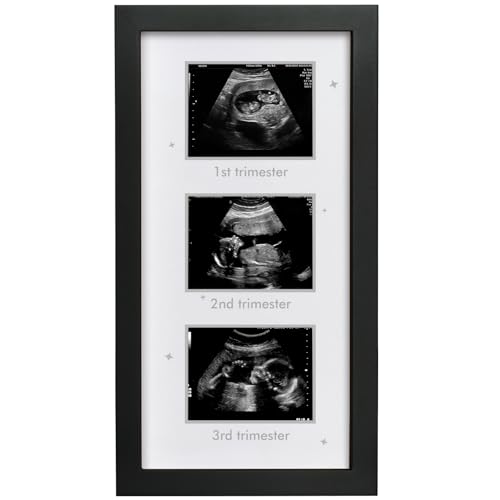 HAMUIERS Ultrasound Picture Frame - Triple Sonogram Frame for Mom to Be | Pregnancy Photo Album Decor | Baby Nursery Essentials & Gender Reveal Gifts | First Trimester Keepsake & Pregnancy Must Haves - Black2