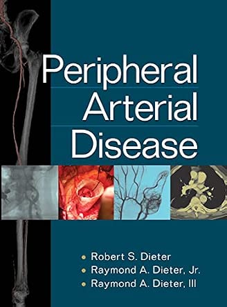 Peripheral Arterial Disease book cover