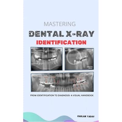 Mastering Dental X-ray Identification