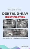 Mastering Dental X-ray Identification : Learn Dental Radiology the Easy Way – Student Notes, Not Textbook” (English Edition)