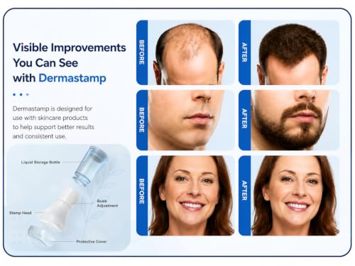 Image of S2 Upgraded Derma Stamp 140 | Adjustable Microneedle Serum Applicator with 10ml Refillable Bottle | Hydra Derma System for Enhanced Absorption & Skin Refresh | Face & Scalp Use