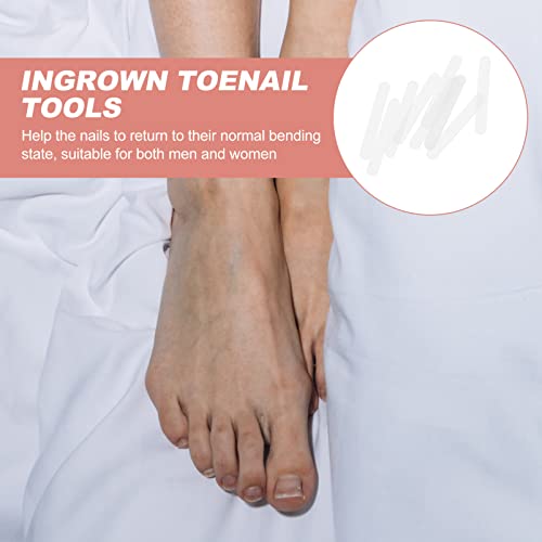 DOITOOL 50 Peças Unha Encravada Corretor de Unha Encravada Corretor de Unha Curvada Correção de Unha