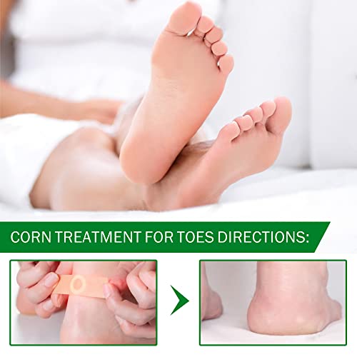 Corn Removers For Feet & Toes, Corn Removers With Salicylic Acid, Corn Removers For Toes Pads, Foot Corn Remover & Callous Remover, Corn Pads For Toes & Feet, 24 Pack #TOP5