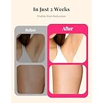 LYSMOSKI Laser Hair Removal for Women and Men, At-Home IPL Hair Removal Device with 5.2 cm² Treatment Window, Nearly Painless, Visible Results in 2 Weeks, Full Body Treatment in 8 Minutes - Image 3