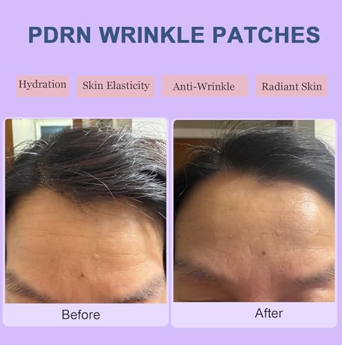 Kewhunt Forehead Wrinkle Patches - 16 Pcs, $9.xx with Coupon - Image 3