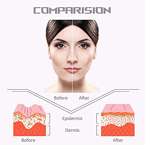 Permotary 5 Pcs V Shaped Facial Masks V Line Chin Lift Patch Chin Up Tightening Mask Great For Chin Up & V Line, Double Chin Reduce, Firming Moisturizing & Contour Lifting #TOP3