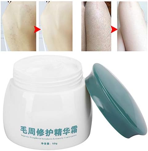 Professional Keratosis Pilaris Cream Body Soothing Chicken Skin Treatment Body Care Cream for Home & Travel 50g