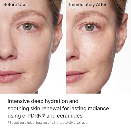 Image of REJURAN Turnover Mask, c-PDRN Face Mask, 5ea x 1.35 fl oz