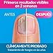 Excilor, Esmalte de uñas - 3.3 ml.