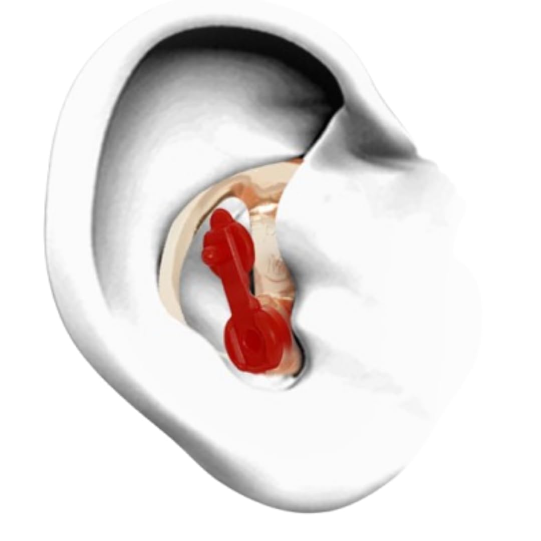 ALVIS Mk5 Taille M — Bouchon Oreille Demi-Mesure Progressif SNR 33 dB, Mousse Comply Interchangeable, Certifié CE EPI, Silicone Médical, Conque jusqu'à 25 mm