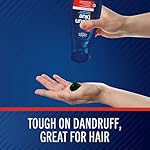 Selsun Blue Medicated Antidandruff Shampoo, Maximum Strength Scalp Treatment With Selenium Sulfide, 11 fl. oz. - Image 4