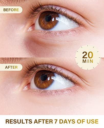 Dr. Pure Under Eye Patches (30 Pairs), Eye Patches For Puffy Eyes, Eye Masks Reduce Dark Circles, Puffy Eyes, Undereye Bags And Wrinkles, Collagen Skin Care Products #TOP2