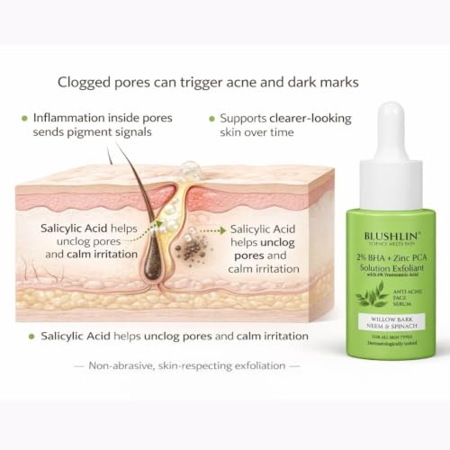 Image of 3% TRX + 2% Salicylic Acid Serum for Acne prone skin, Pigmentation, Open Pores, Oily Skin & Blackheads | Face Serum for Acne and Dark Spots for Men & Women 30ml