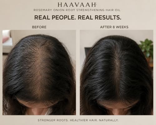 Image of Rosemary Onion Scalp and Root Strengthening Hair Oil (Castor, Jojoba, Almond, Curry Leaves and Biotin- Vetiver roots infused) 100 ml (Rosemary Onion Root Strengthening Hair Oil)