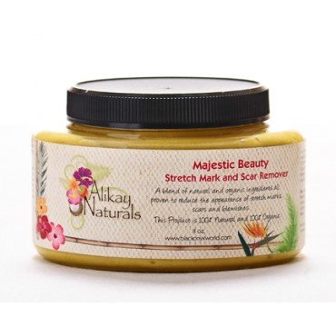 Alikay Naturals - Majestic Beauty Stretch Mark and Scar Remover 8oz