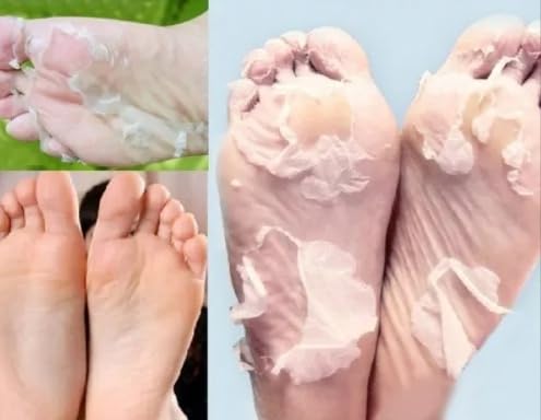 Esfoliante Pé Peeling Mascara Para Remover Pele Morta Repara calcanhares ásperos, calos e pele morta