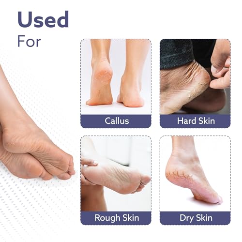 Image of AGARO Callus Remover Replaceable Heads, 2 Pcs, Callus & Dead Skin Removal Filer, Pedicure at Home