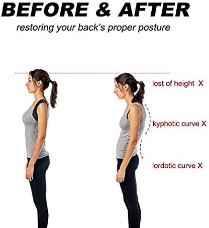 Hecmoks Posture Corrector Back Support Brace for Men and Women - Improves Posture, Prevents Slouching and Hunching, Reliefs Upper Back and Neck Pain - Adjustable and Comfortable with Underarm Pads