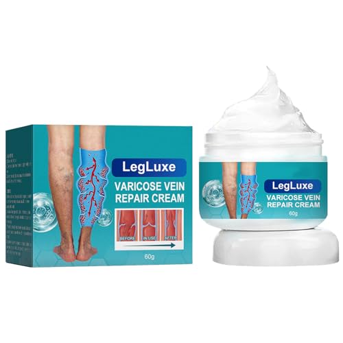 Crema Eliminación de Venas Varicosas,Crema para Varices Piernas,Crema para Eliminar