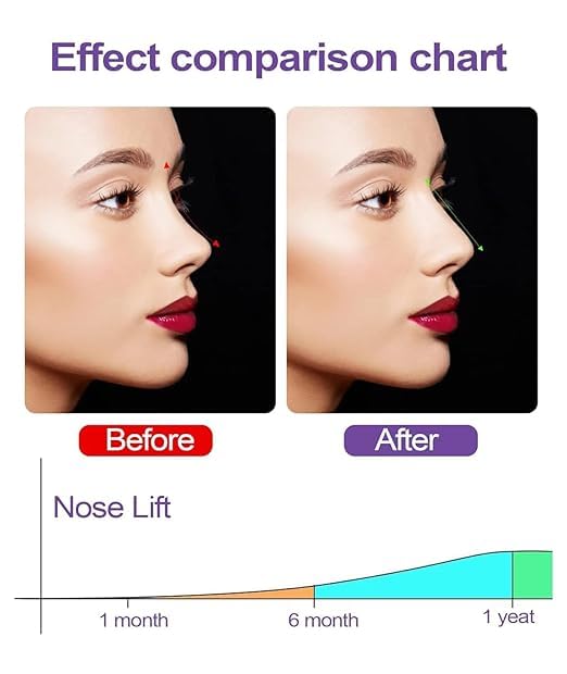 JAMBUVANTI Silicone Nose Shaper Clip Nose Corrector Device for Nose Bridge Straightening and Lifting - Soft and Safe Non Surgical Nose Up Beauty Tool(Pack of-1) (Nose Up Clip) 3