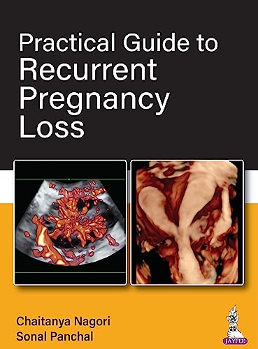 Practical Guide to Recurrent Pregnancy Loss (English Edition) - Nagori, Chaitanya