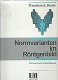  Normvarianten im Röntgenbild. Befunde ohne Krankheitswert