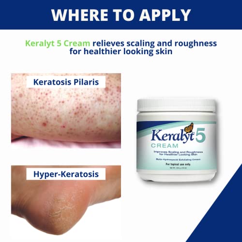5% Salicylic Acid Psoriasis Cream - Full Body Exfoliating Lotion for Itchy, Red, Dry, Rough, and Flaky Skin Relief