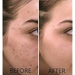 Vitamin C Serum 20% Pure L-Ascorbic Acid, Ferulic Acid, Vitamin E and HA and Hyaluronic Acid Serum with Vitamin B5 for Face and Eyes Natural Anti Aging Anti Wrinkle Set of 2 by Dr. Brenner - Image 3