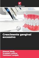 Crescimento gengival excessivo (Portuguese Edition) 620873956X Book Cover